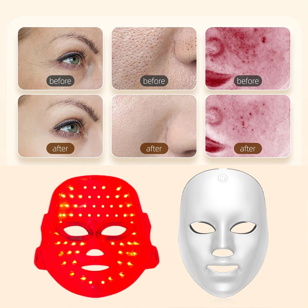 Before and after results using LED light therapy mask